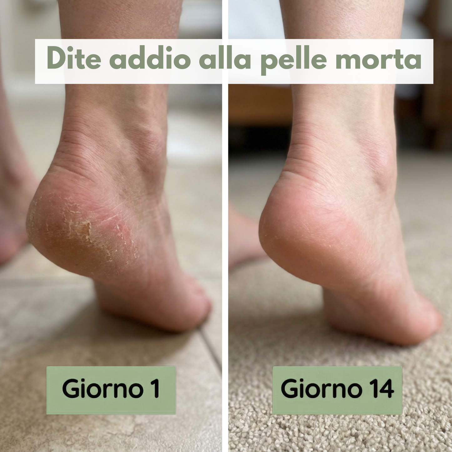 Sapone antimicotico Safinera - Piedi sani, senza micosi.